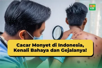 cacar monyet di indonesia